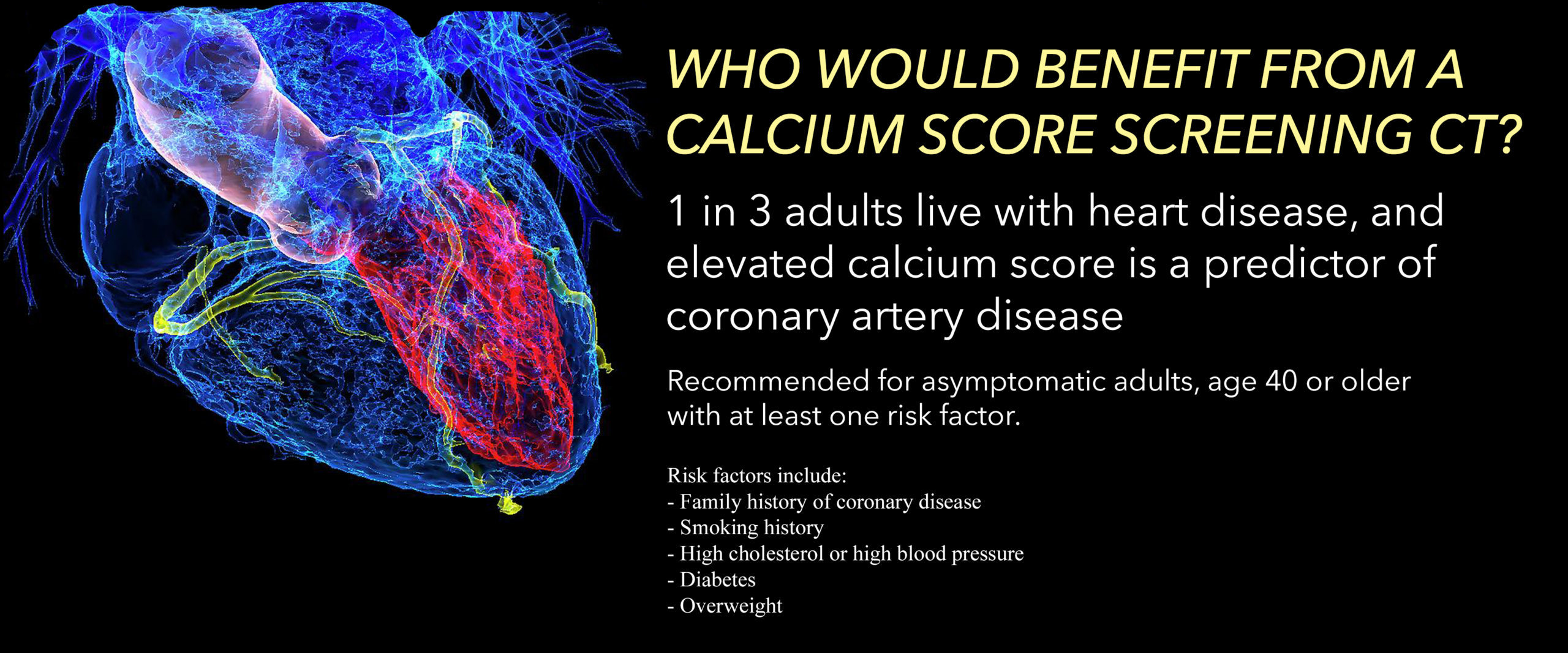 CT Coronary Artery Calcium Scoring Mt Baker Imaging